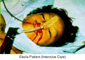Paciente com Ebola, UTI