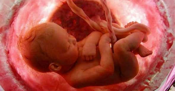Bebe na placenta